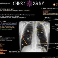 Identifying x rays haspi answer key