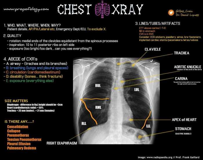 Identifying x rays haspi answer key