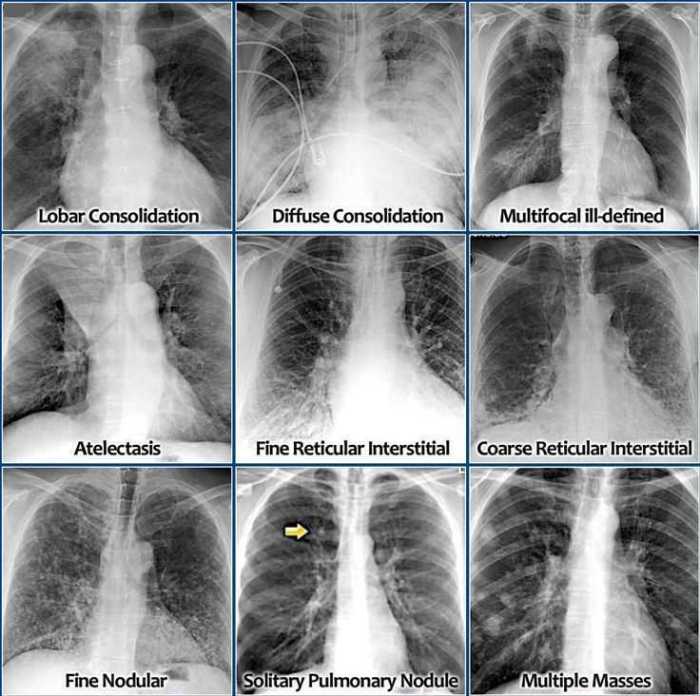 Identifying x rays haspi answer key