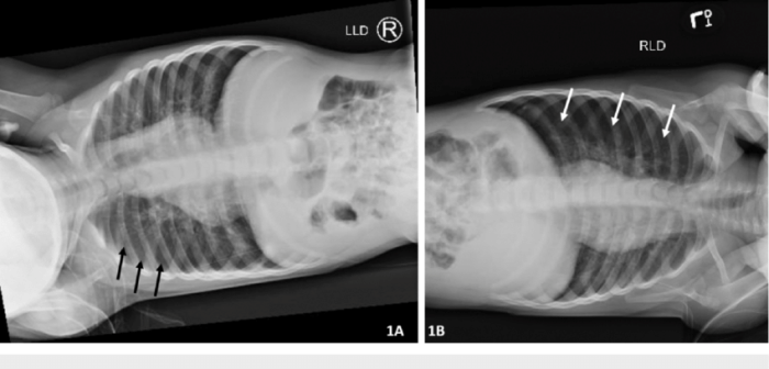 Left lateral decubitus position x ray