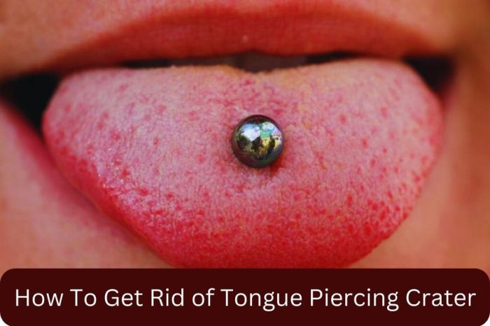 How to get rid of tongue piercing crater