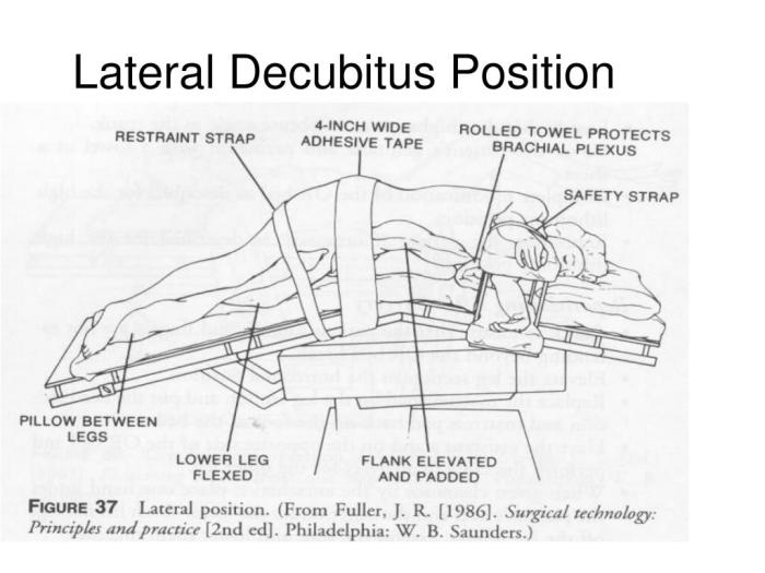 Left lateral decubitus position x ray